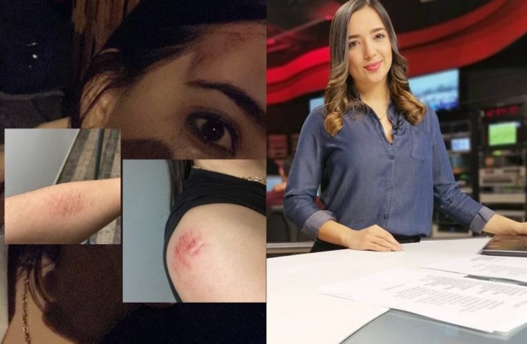 Presentadora de noticias sufre una violenta agresión tras tomar un taxi en Bogotá